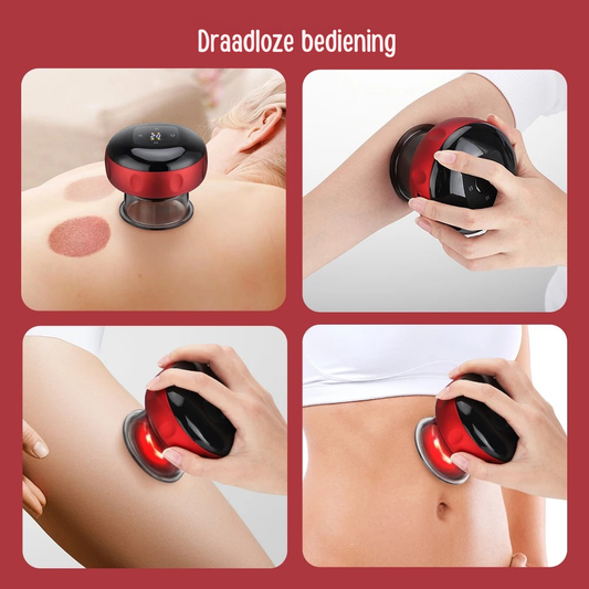 CUPPY de Slimme Elektrische Cupping Massager