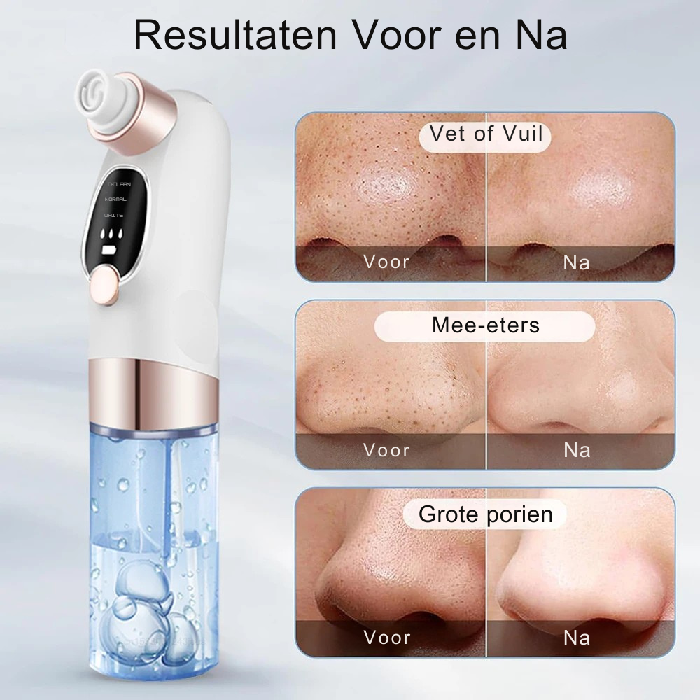 Dewy 3-in-1 Gezichtsreiniger